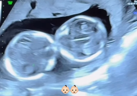 초아 인스타그램