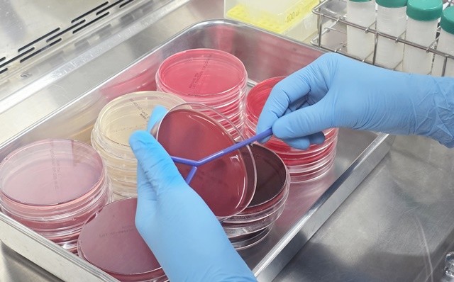 고품질 원유 생산- 유방염 검사