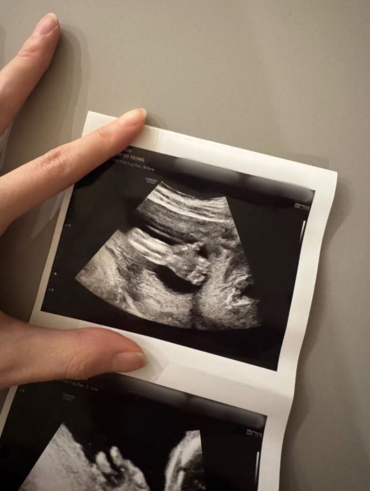 김소영이 임신 사실을 밝히며 함께 게시한 이미지. / 김소영 인스타그램