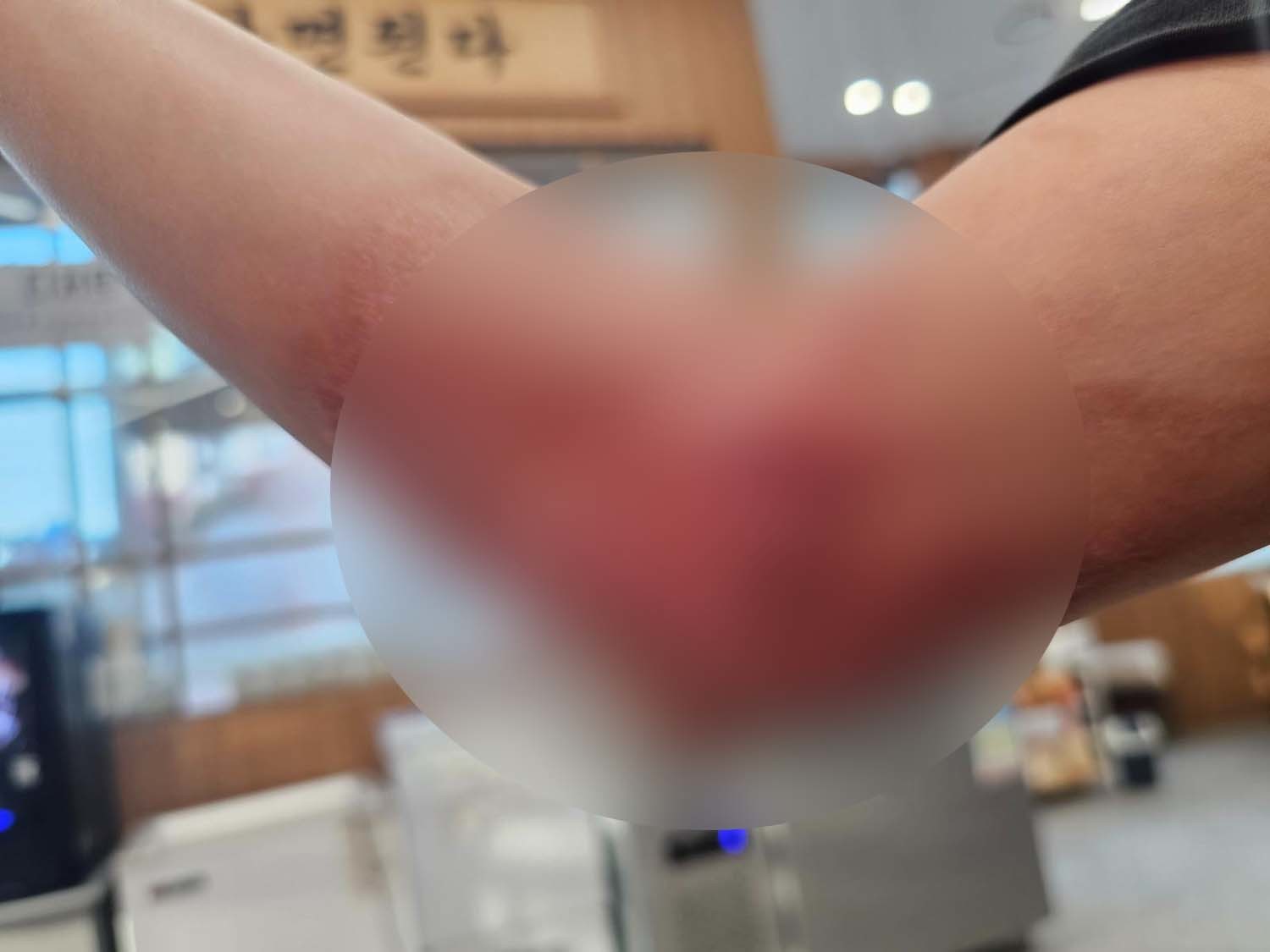 A씨가 공개한 사진. / 보배드림