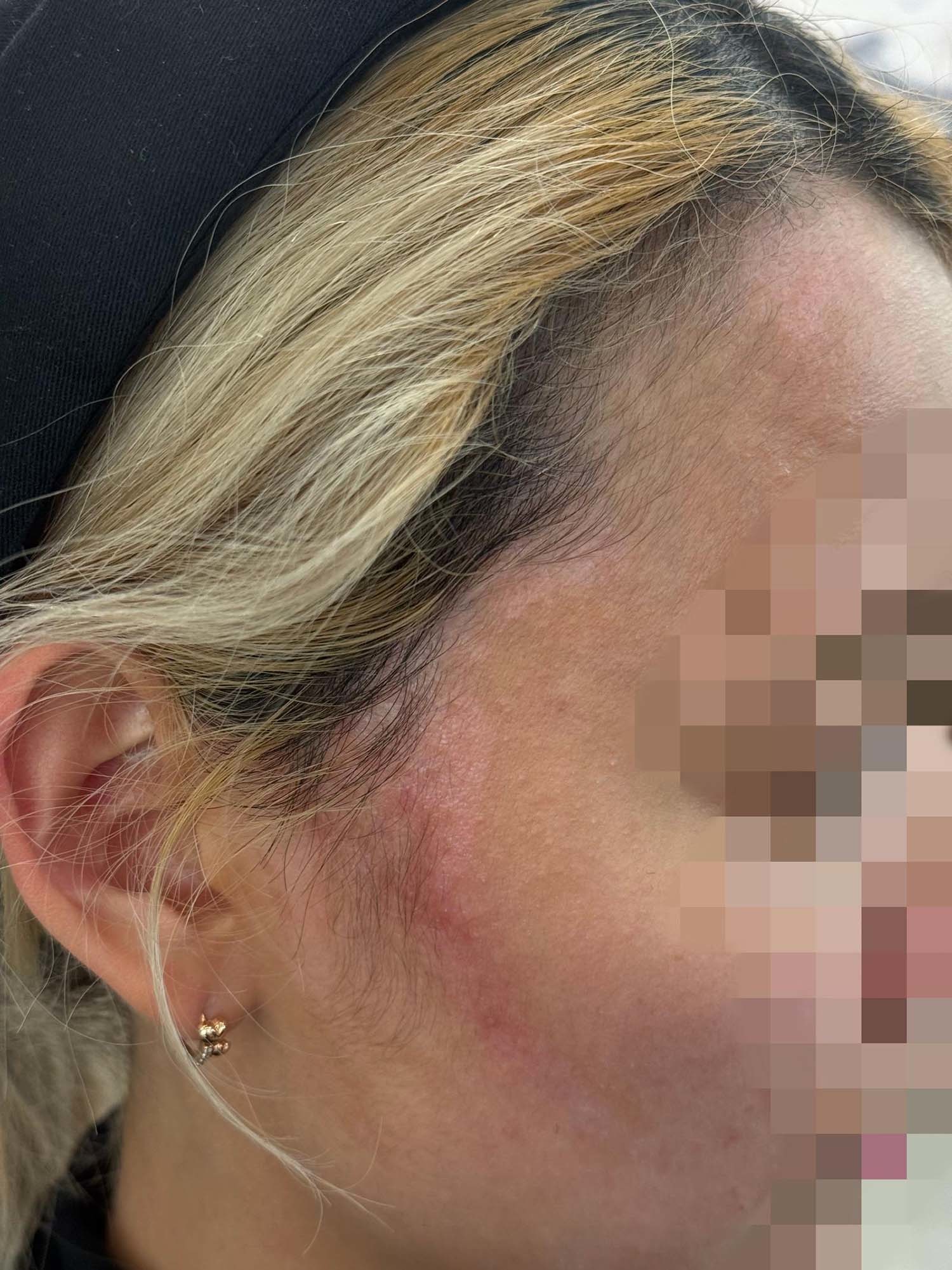 A씨가 공개한 사진. / 보배드림