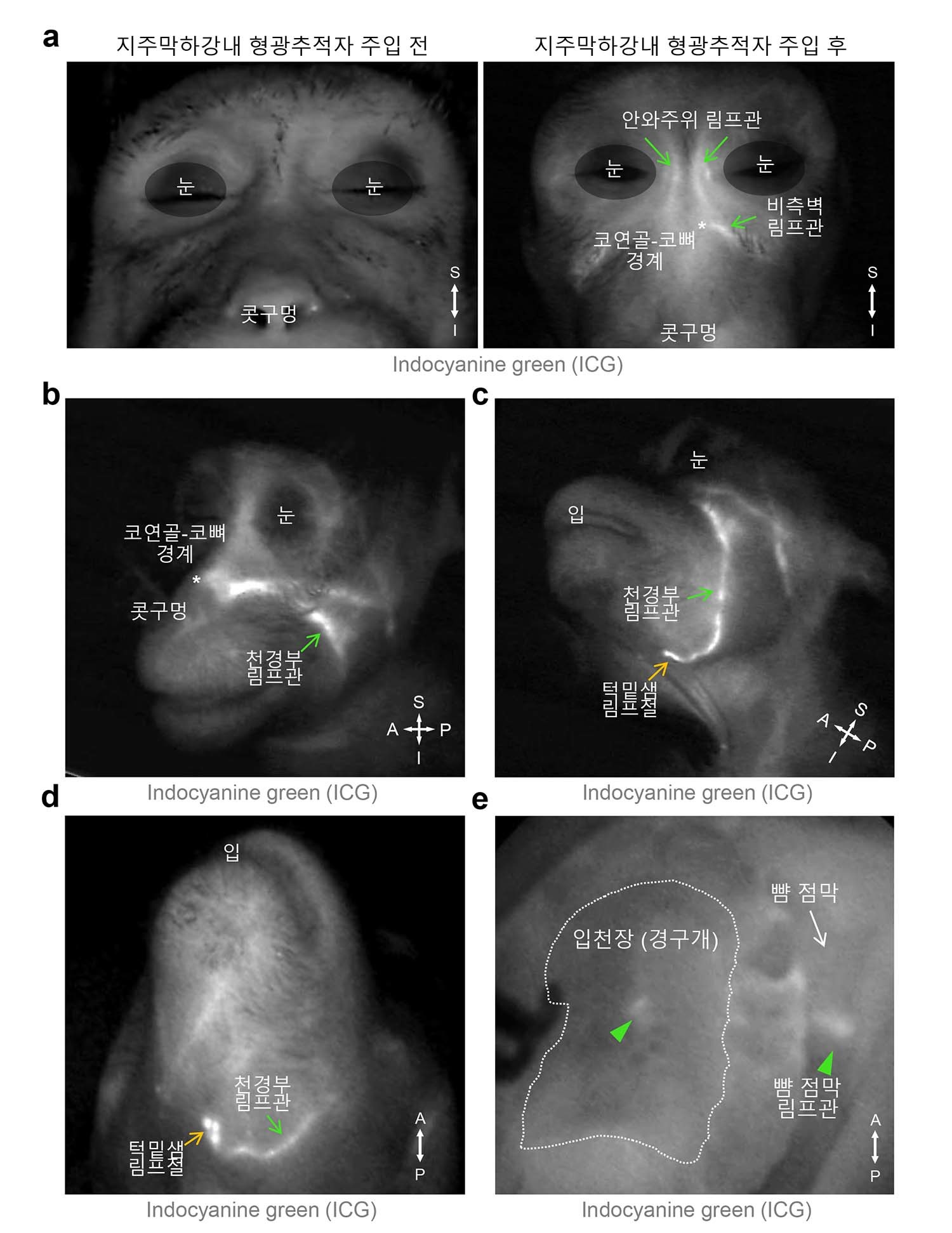 영장류에서 관찰된 뇌척수액 배출 림프관 분포 지주막하강 내 주입된 뇌척수액 형광 추적자가 안와주위, 비측벽, 천경부 림프관에서 관찰됐으며 턱밑샘 림프절에서 형광 축적이 확인됐다. 입천장과 뺨 안쪽 점막 림프관에서도 형광이 관찰되어 생쥐 실험 결과와 일치하는 패턴을 보인다. / 기초과학연구원(IBS) 혈관연구단