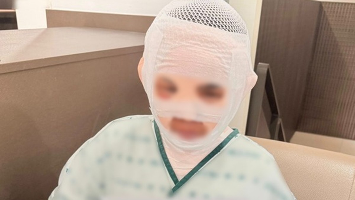 얼굴에 화상을 입은 태국인 아내 모습 / 태국인 아내 지인 페이스북 캡처