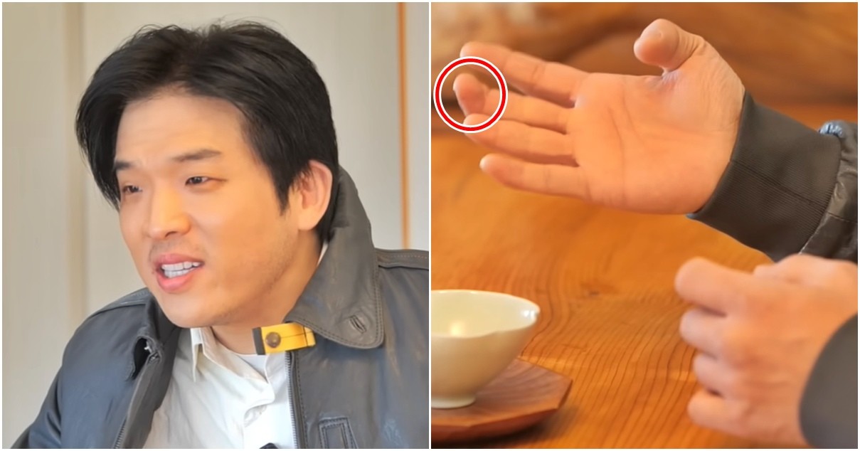 안성재 셰프가 어린 시절 겪었던 손가락 절단 사고의 아픔을 고백하고 있다. / 유튜브 ' 셰프 안성재'