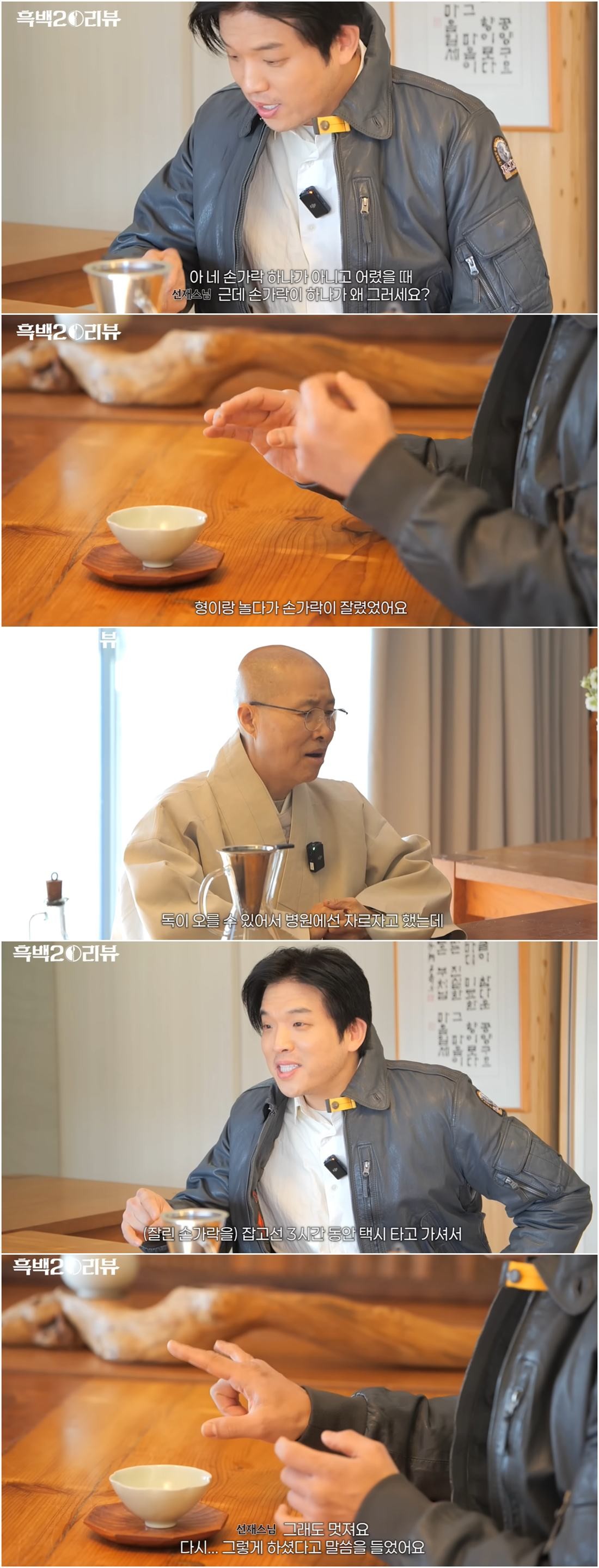 안성재 셰프가 어린 시절 겪었던 손가락 절단 사고의 아픔을 고백하고 있다. / 유튜브 ' 셰프 안성재'