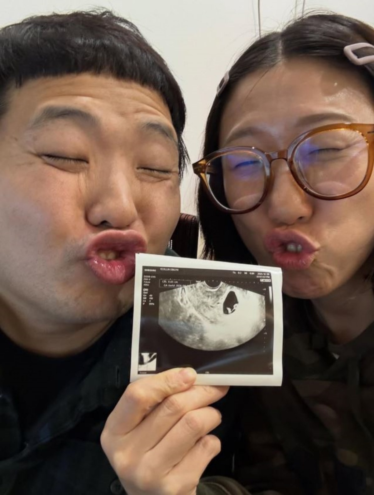 개그맨 부부이자 유튜브 채널 '흔한남매' 멤버인 한으뜸(왼)과 장다운(오). / 흔한남매 공식 인스타그램