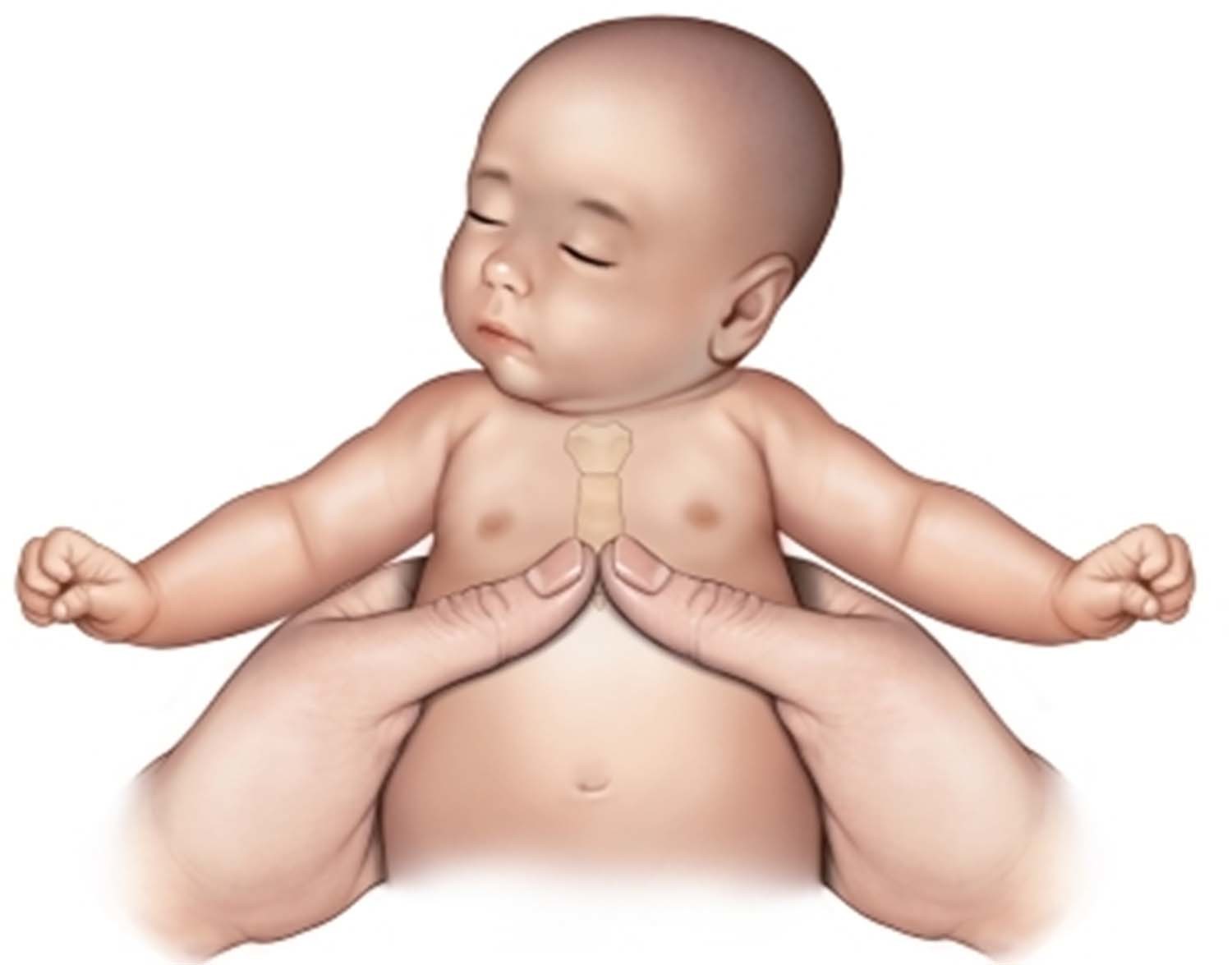 변경 후 압박법. 두 손가락 압박법. / 질병관리청