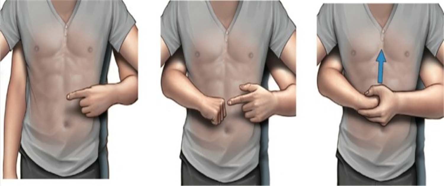 복부 밀어내기(하임리히법). / 질병관리청