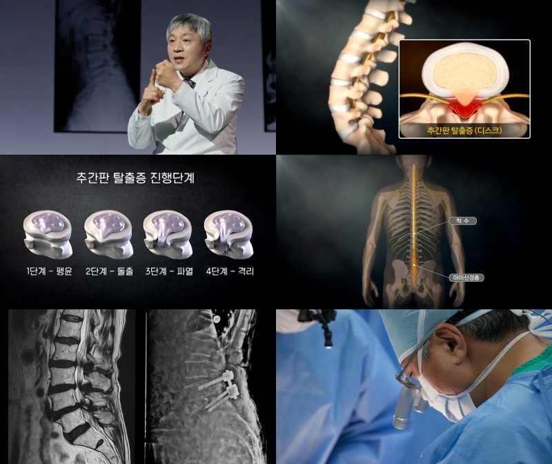 EBS '명의' 957회 방송 스틸모음. / EBS 제공