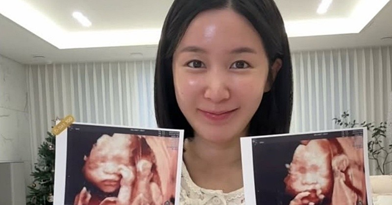 초아 인스타그램