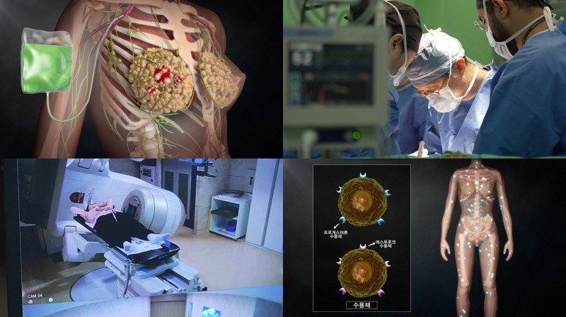 EBS '명의' 959회 방송 스틸모음. / EBS 제공