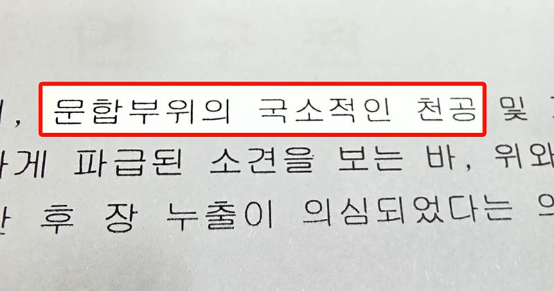 부검감정서 일부 / 유튜브 ' 캔디 KANDY_KBS제주'