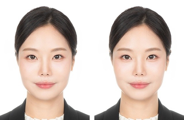 전남대 치전원 김유리 학생