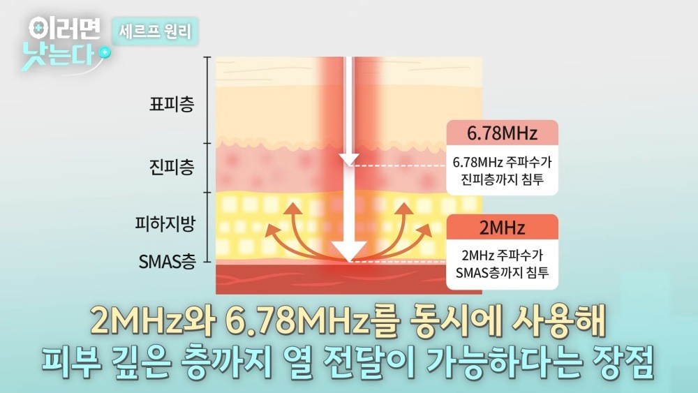 이하 유튜브 채널 ‘조선일보 의학·건강’