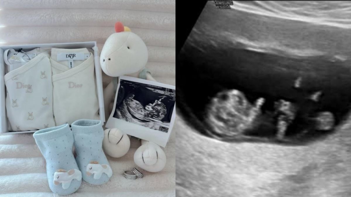나현이 직접 게시한 아기용품과 초음파 사진. / 나현 인스타그램
