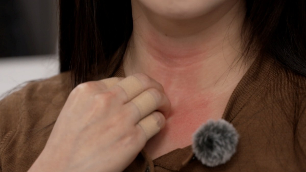 EBS '명의' 962회 방송 스틸컷. / EBS 제공