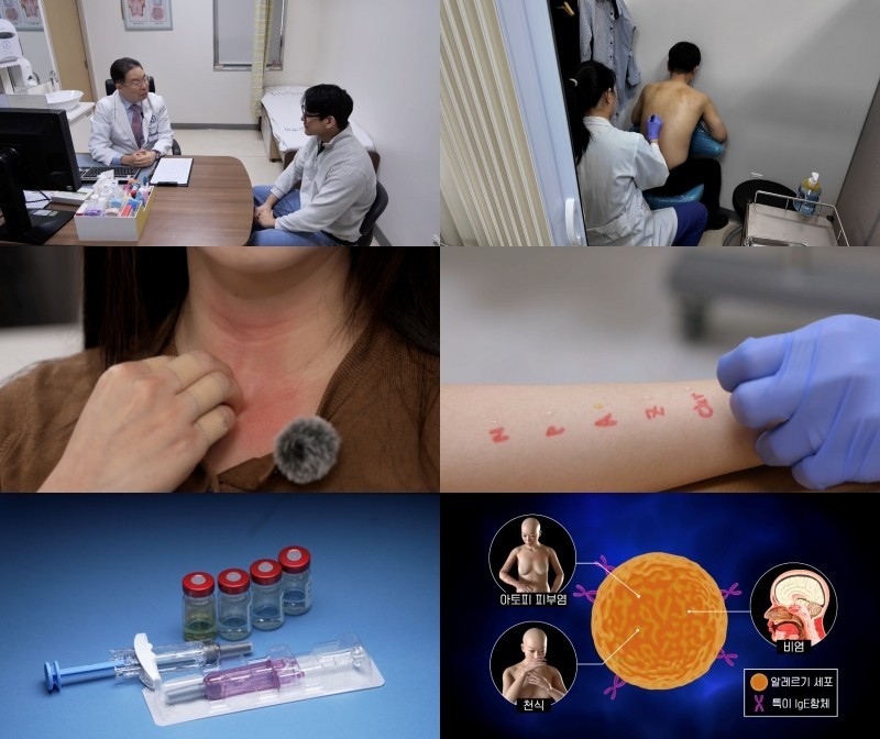 EBS '명의' 962회 방송 스틸모음. / EBS 제공