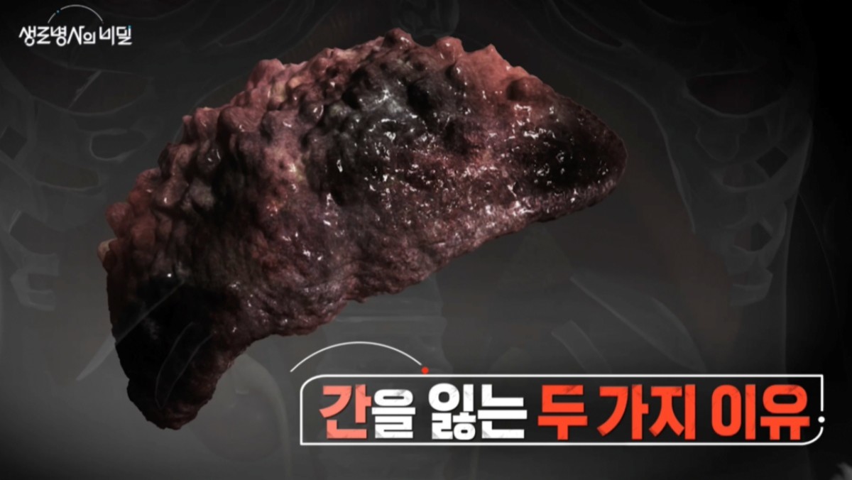 '생로병사의 비밀' 986회 방송자료. / '생로병사의 비밀' 공식 홈페이지