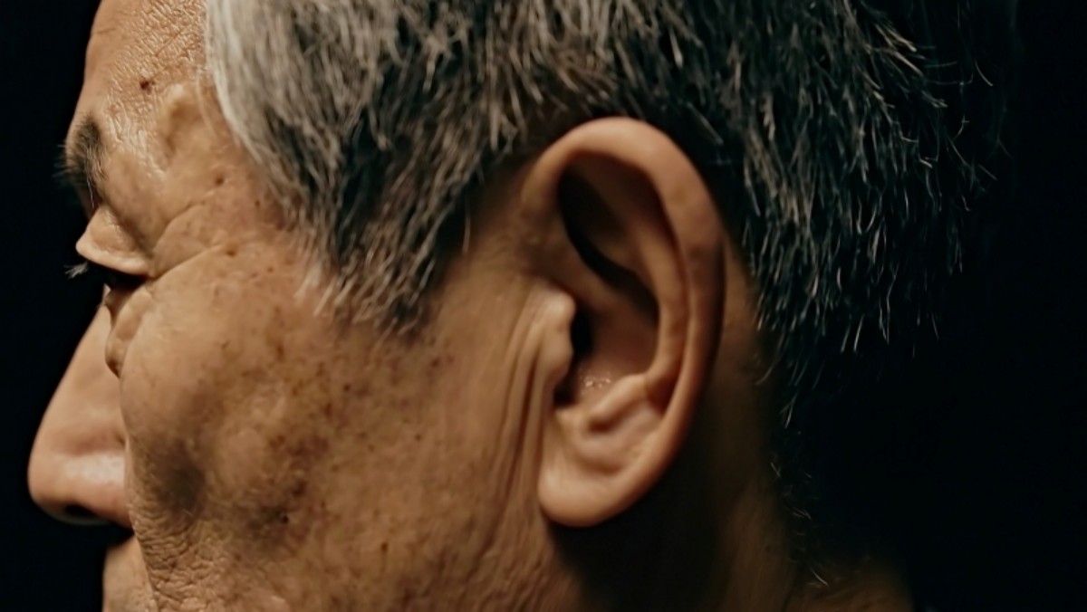 EBS '명의' 963회 방송 스틸컷. / EBS 제공