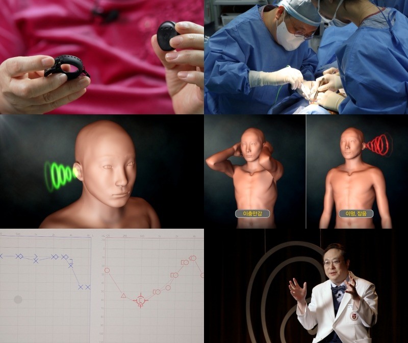 EBS '명의' 963회 방송 스틸모음. / EBS 제공