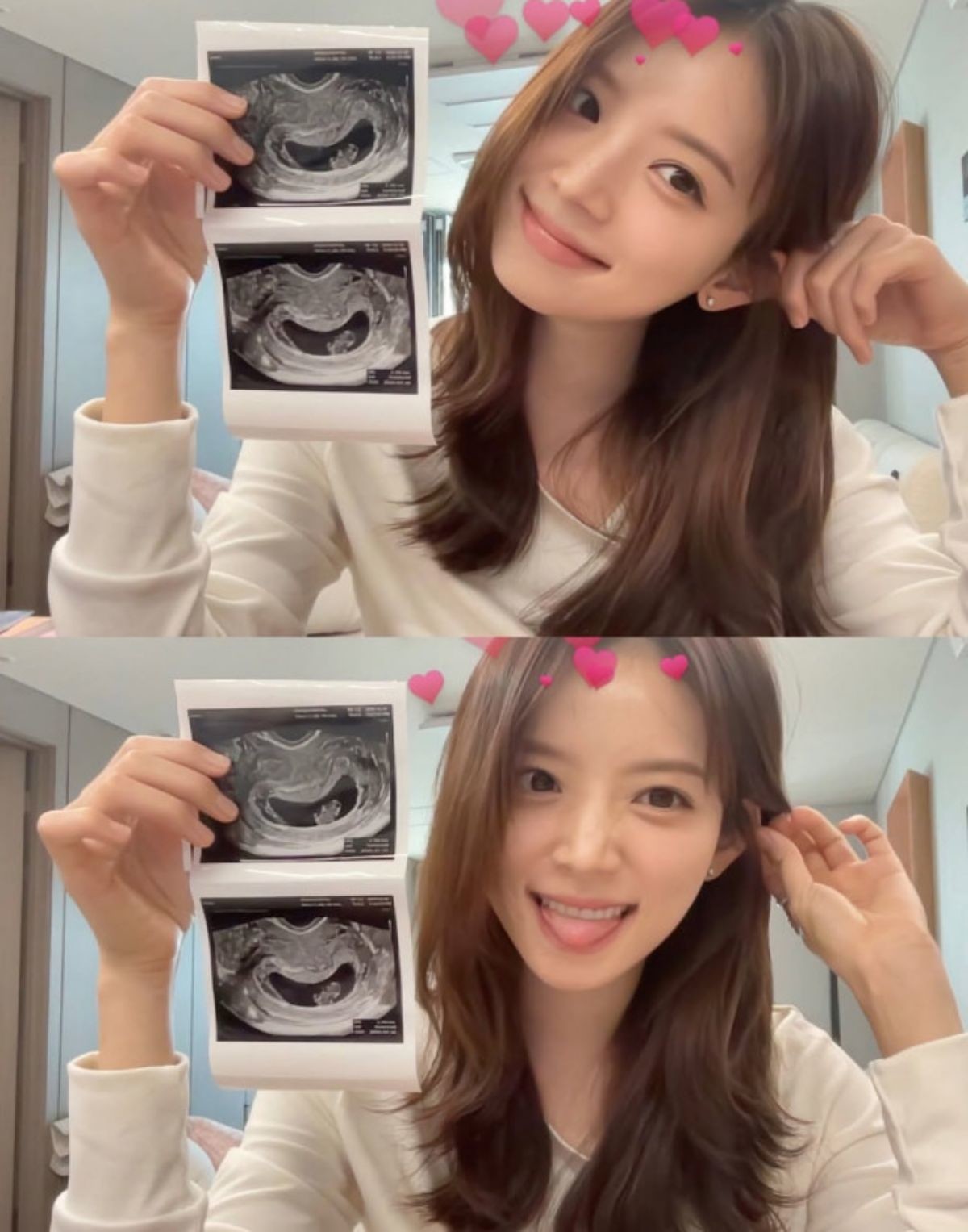 예비맘 김지영. / 김지영 인스타그램