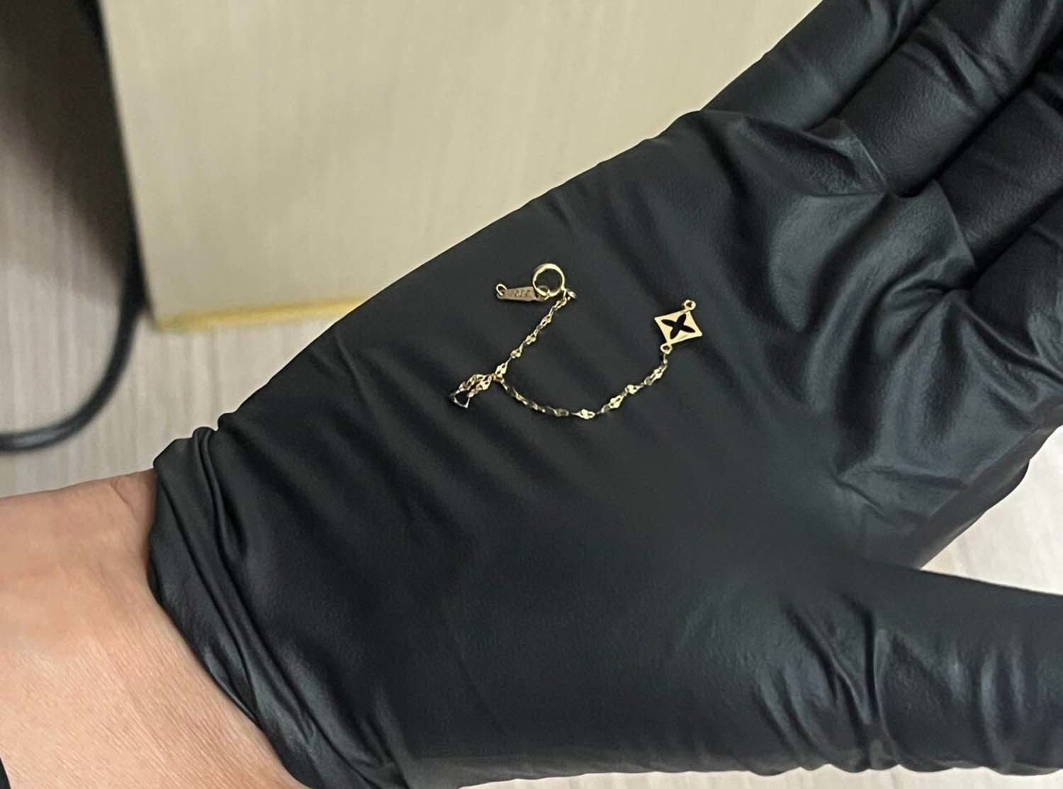 글쓴이가 올린 발찌 사진. / 블라인드