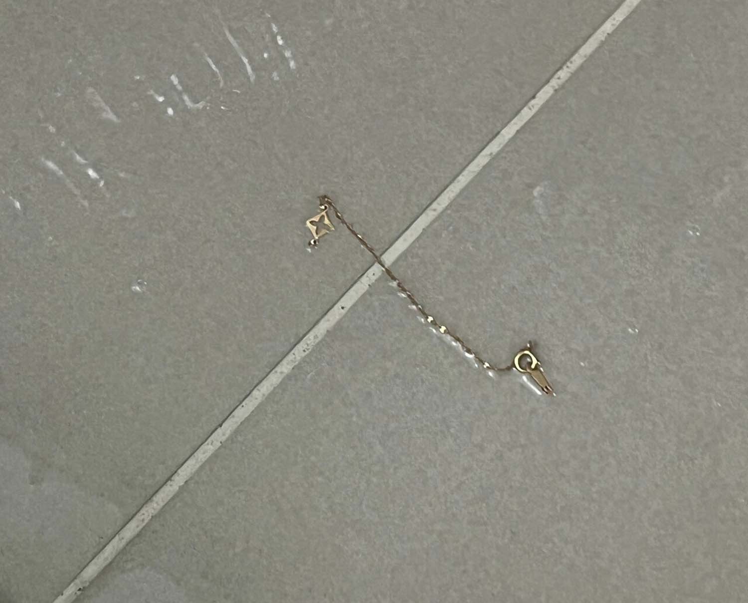 글쓴이가 올린 발찌 사진. / 블라인드