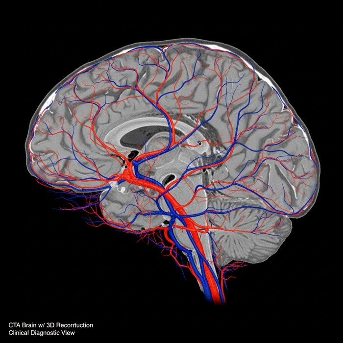 기사의 이해를 돕기 위한 AI 생성 이미지