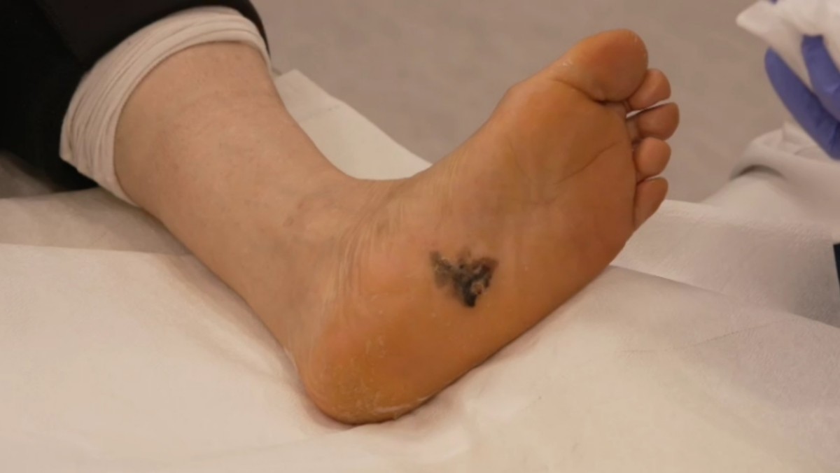 EBS '명의' 966회 방송 스틸컷. / EBS 제공