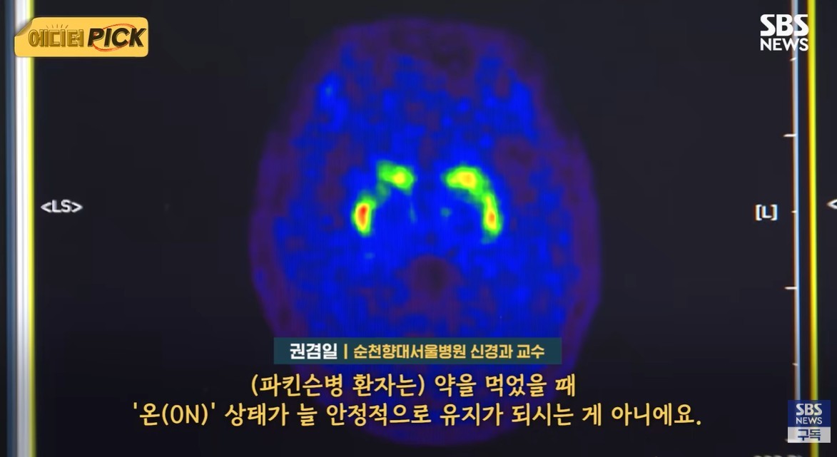 유튜브 'SBS 뉴스'