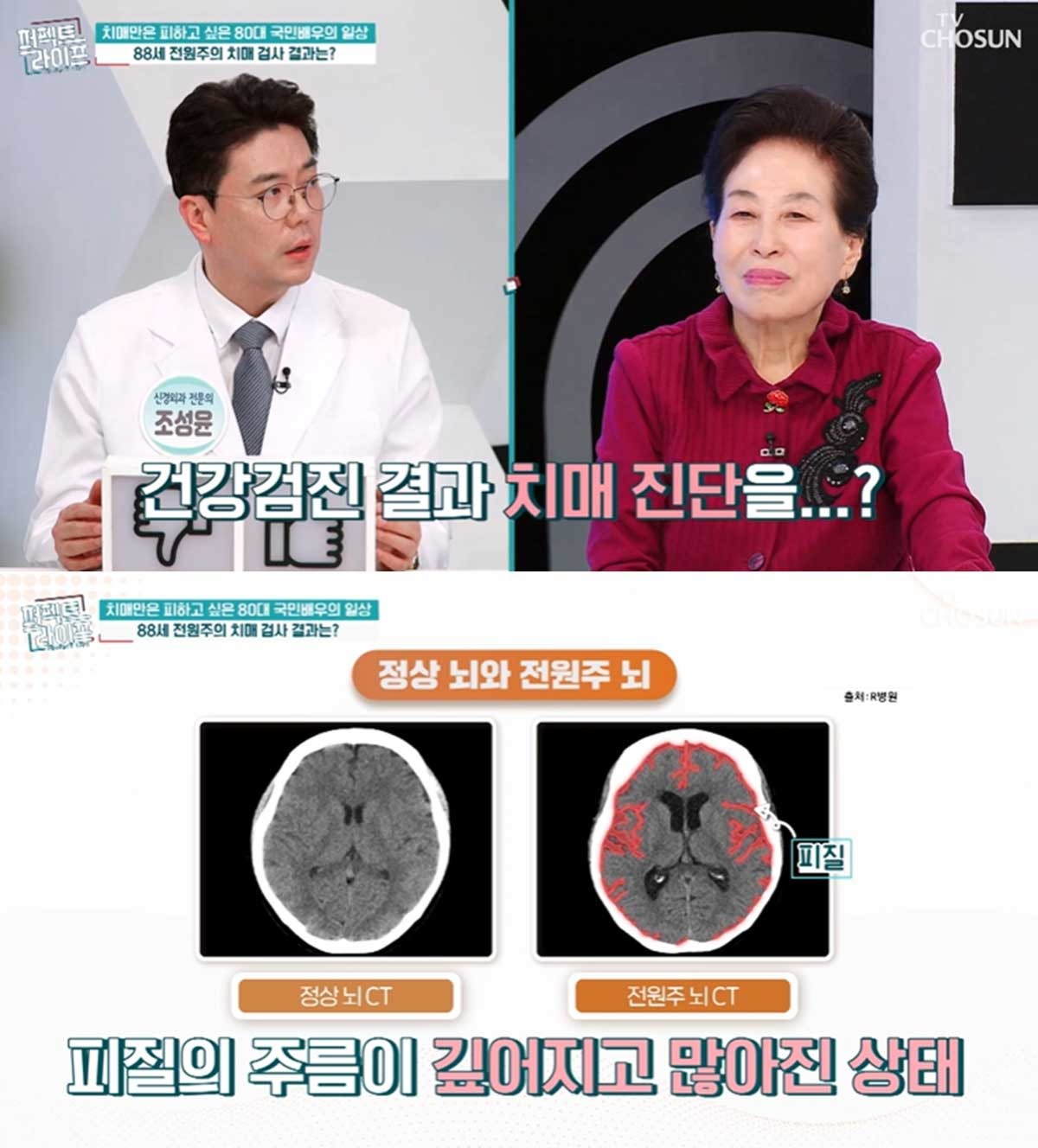 전원주가 치매 초기 진단을 받은 것으로 알려졌다. / TV조선 '퍼펙트 라이프', 뉴스1