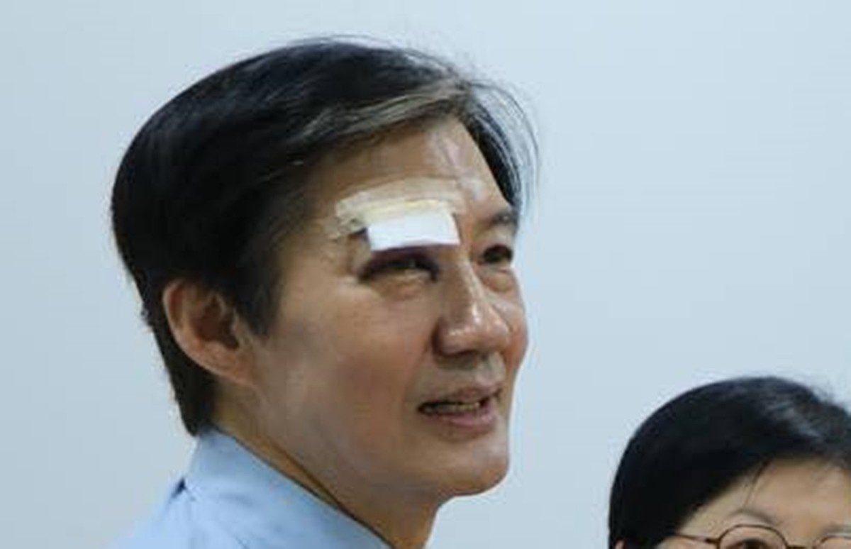 눈 부위에 부상을 당한 조국 조국혁신당 대표 / 조국 대표 페이스북