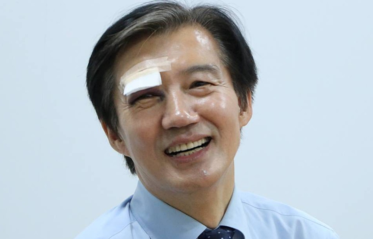 눈 부위에 부상을 당한 조국 조국혁신당 대표 / 조국 대표 페이스북