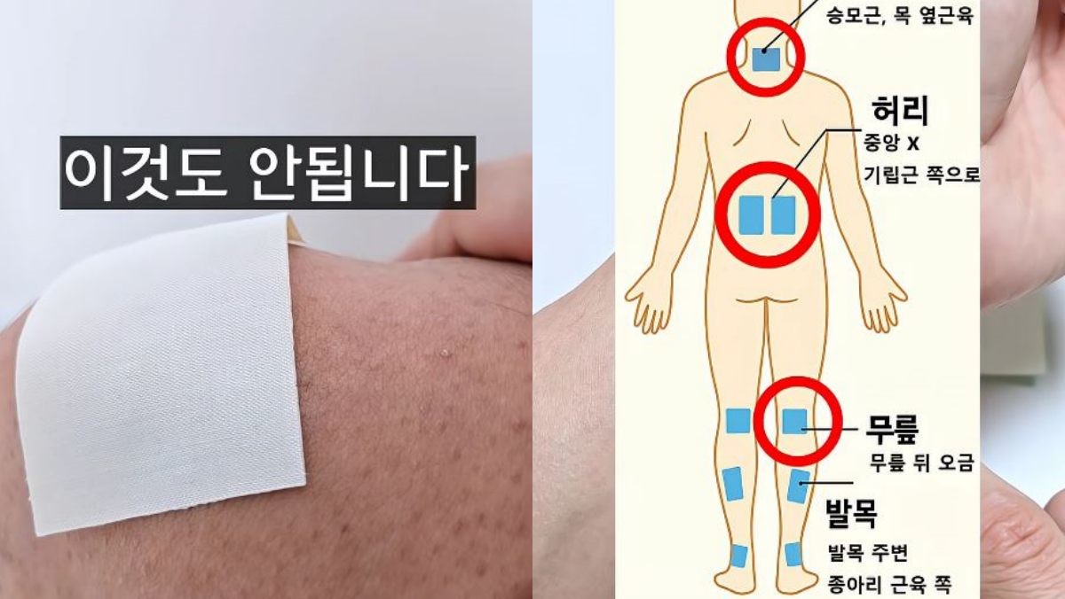 무릎 뼈에 파스를 붙인 모습(왼)과 올바른 파스 부착 위치(오). / 유튜브 '1분미만'