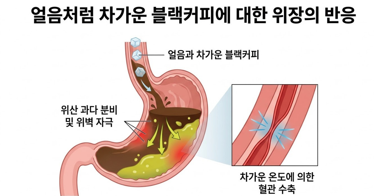 단순 자료 사진. 기사 이해를 돕기 위해 AI로 제작한 이미지.