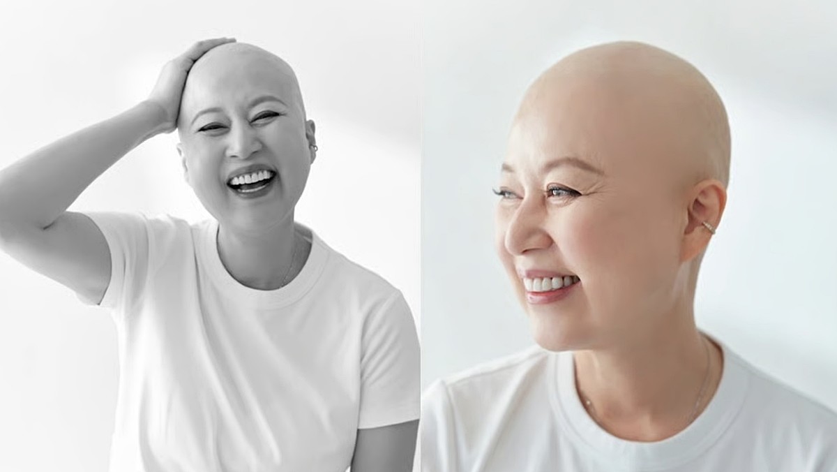 유방암 항암 치료 당시 삭발 사진을 공개한 박미선 / tvN '유 퀴즈 온 더 블럭'