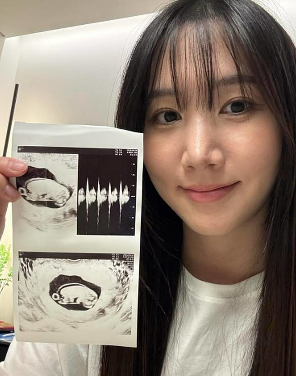 셀카와 함께 임신 사실 공개한 홍유경 / 홍유경 인스타그램