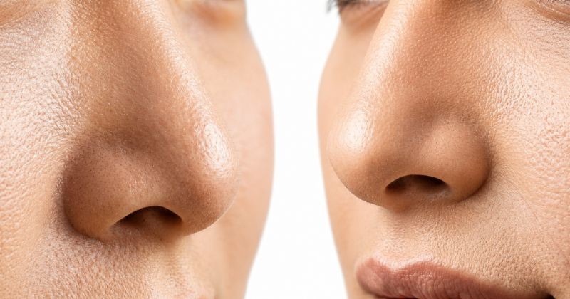 코 성형 문화가 발달한 국가들에서 자주 비교되는 코 형태를 보여주는 이미지다. / AI가 생성한 자료사진