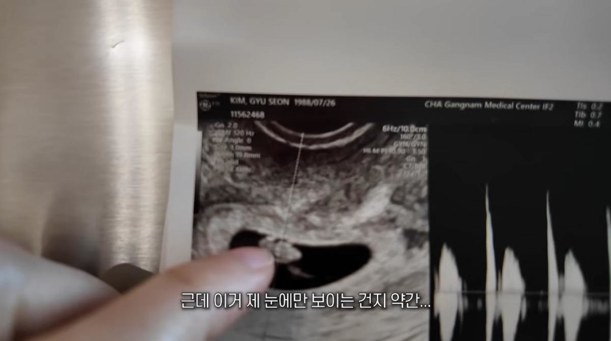 김규선이 공개한 초음파 사진. / 유튜브 '귯와이프 김규선'
