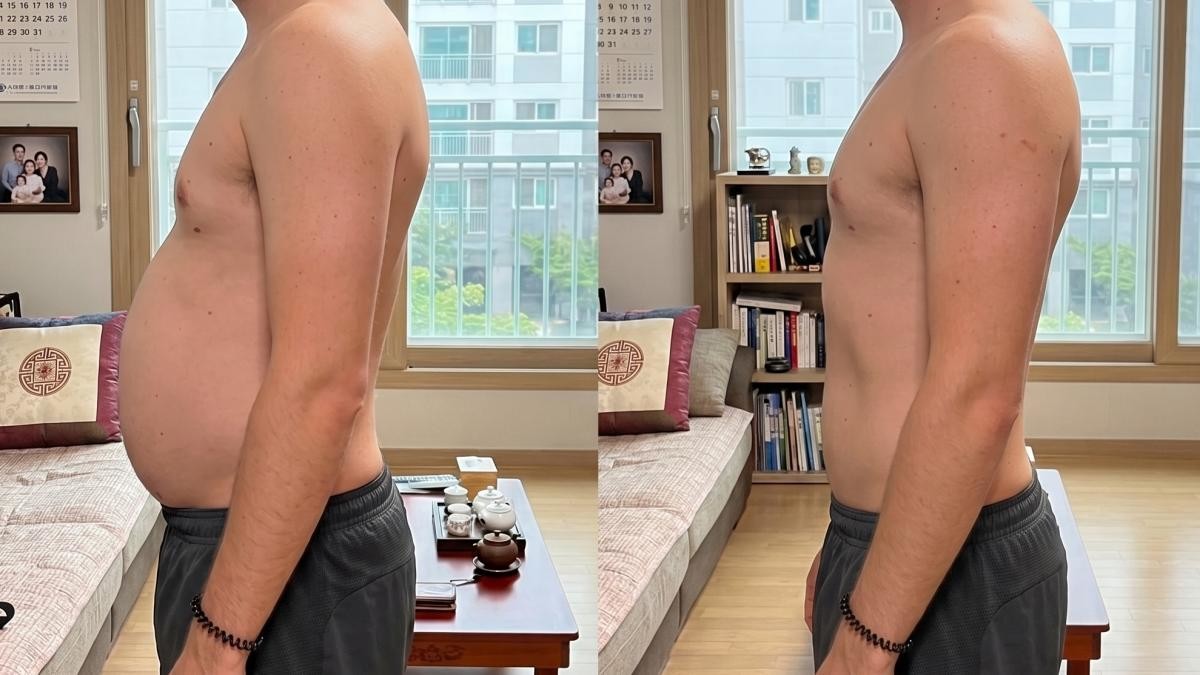 다이어트 전, 후 모습. 기사 내용 토대로 AI툴 활용해 제작한 자료사진.