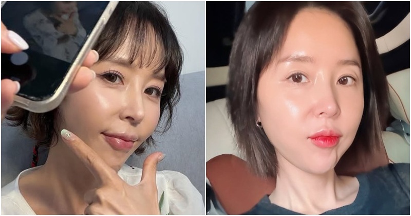 성형 의혹 휘말렸던 신지, 알고 보니 '병'이었다..."한 달 치료 필요"