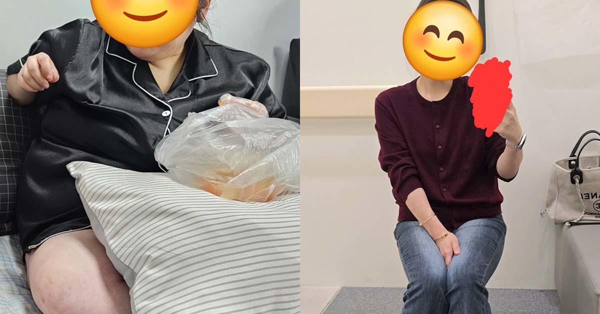 '몸무게 125kg' 여자가 55kg 감량하고 올린 전후 사진... 네티즌 "인간승리"