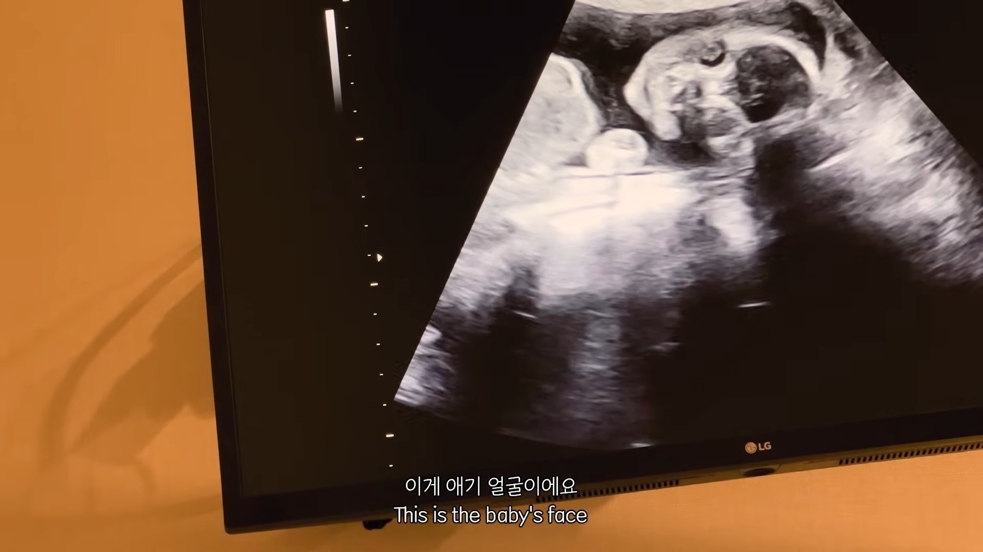 박주호 아내 안나가 유튜브 채널을 통해 넷째 임신 소식을 알렸다. / 유튜브 '안나와_ With ANNA'