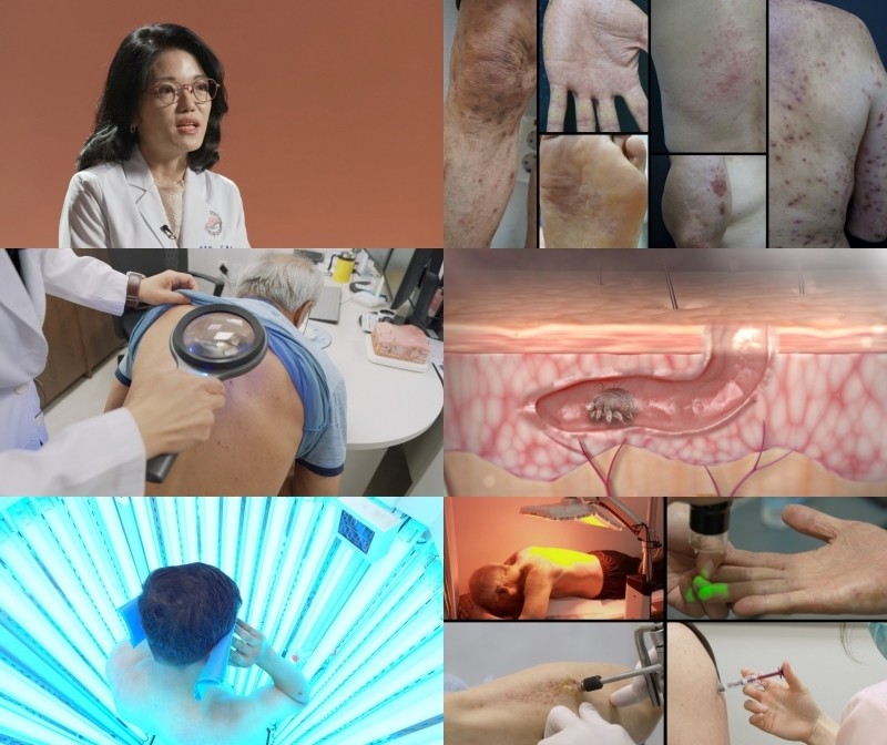 '명의' 988회 방송 스틸모음. / EBS