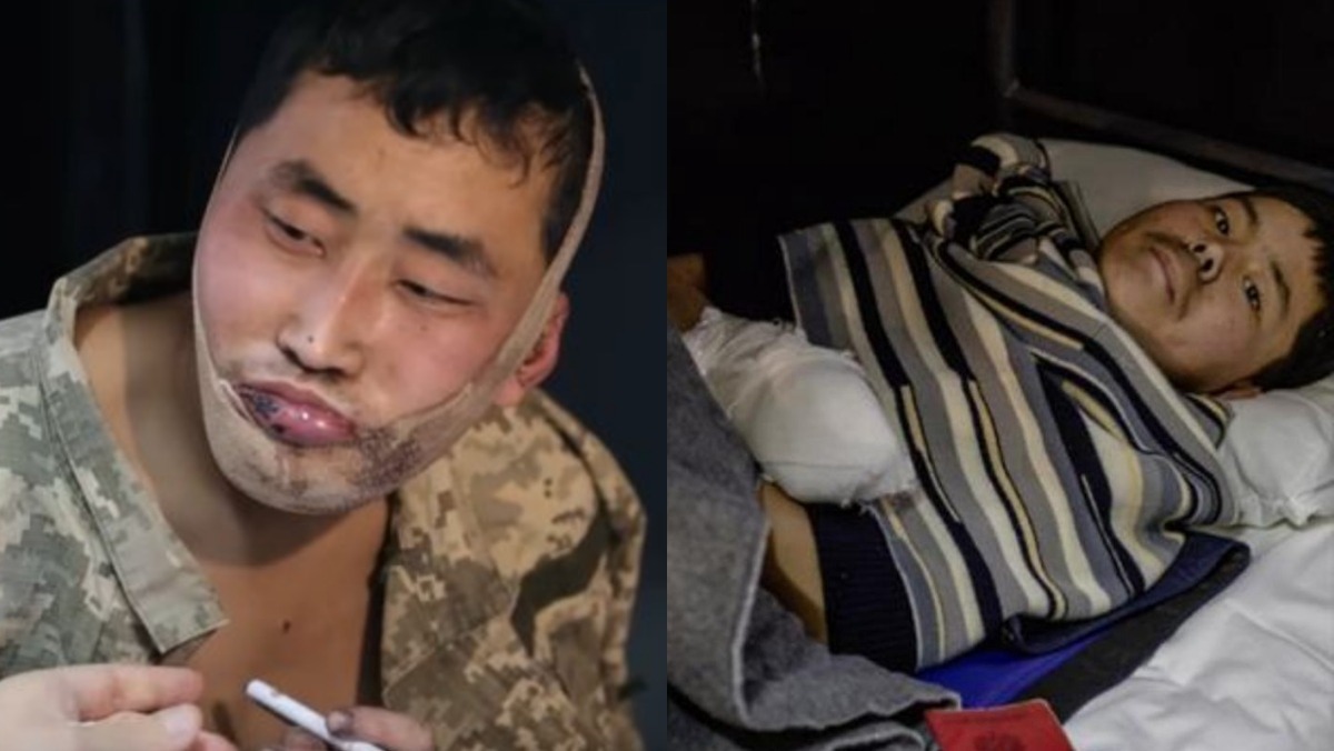 우크라 북한군 포로 2명 귀순 수순?…젤렌스키 “한국 보냈다”, 정부도 사실상 시인