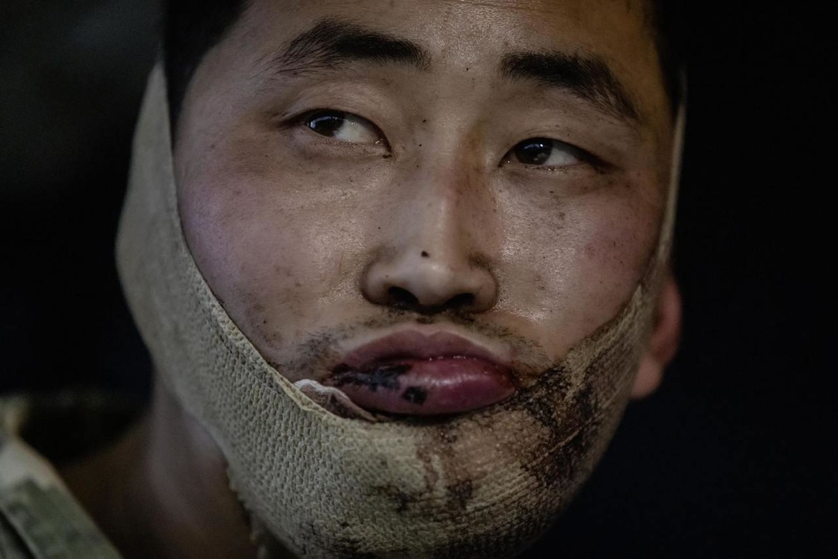 볼로디미르 젤렌스키 대통령이 공개한 북한 군인. / 젤렌스키 대통령 X 캡처
