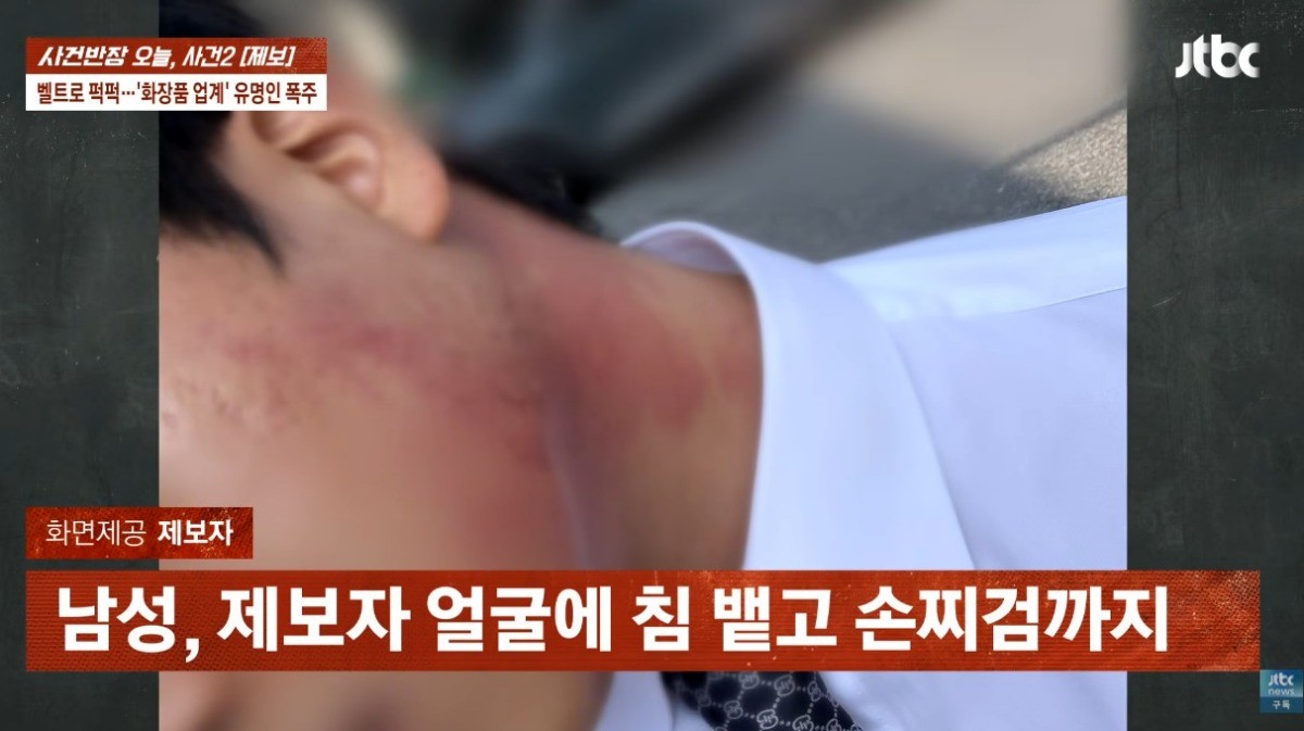 폭행 피해 사진. 사건반장 캡처. / 유튜브 'JTBC News'