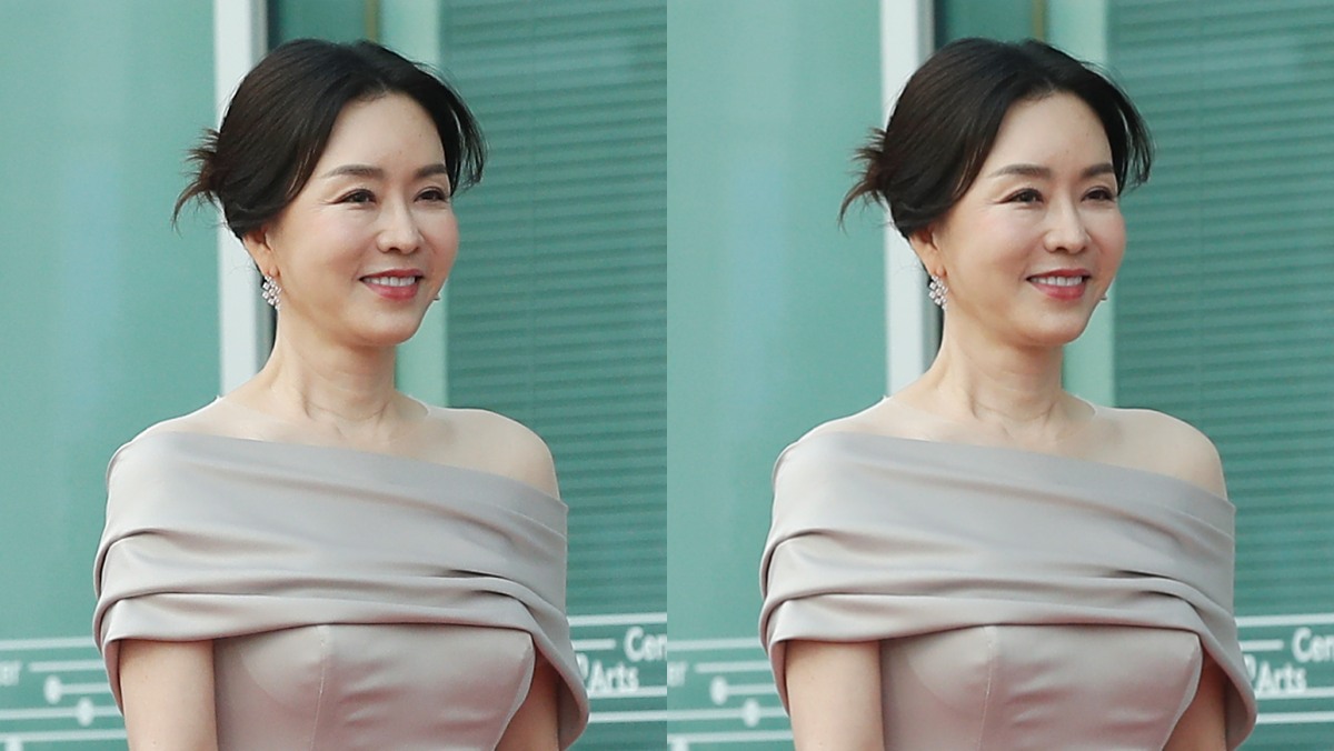 "어려운 시간 보냈다"… 뒤늦게 갑상샘앞 수술 후 심경 고백한 '여배우'