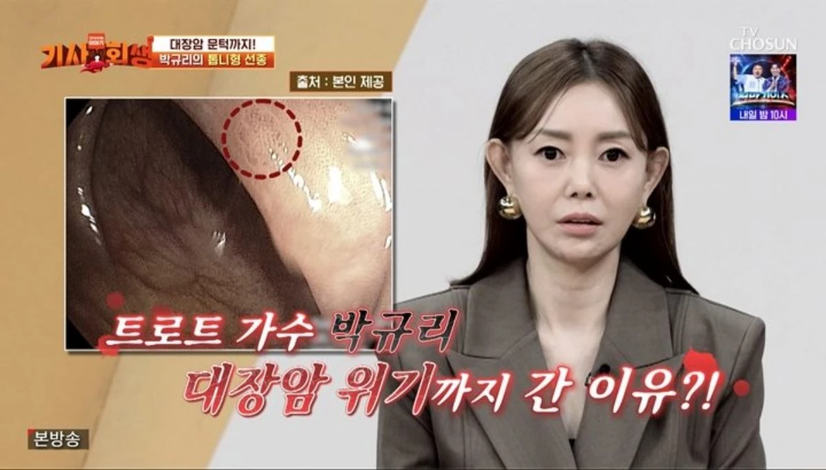 TV조선 예능프로그램 '기사회생'