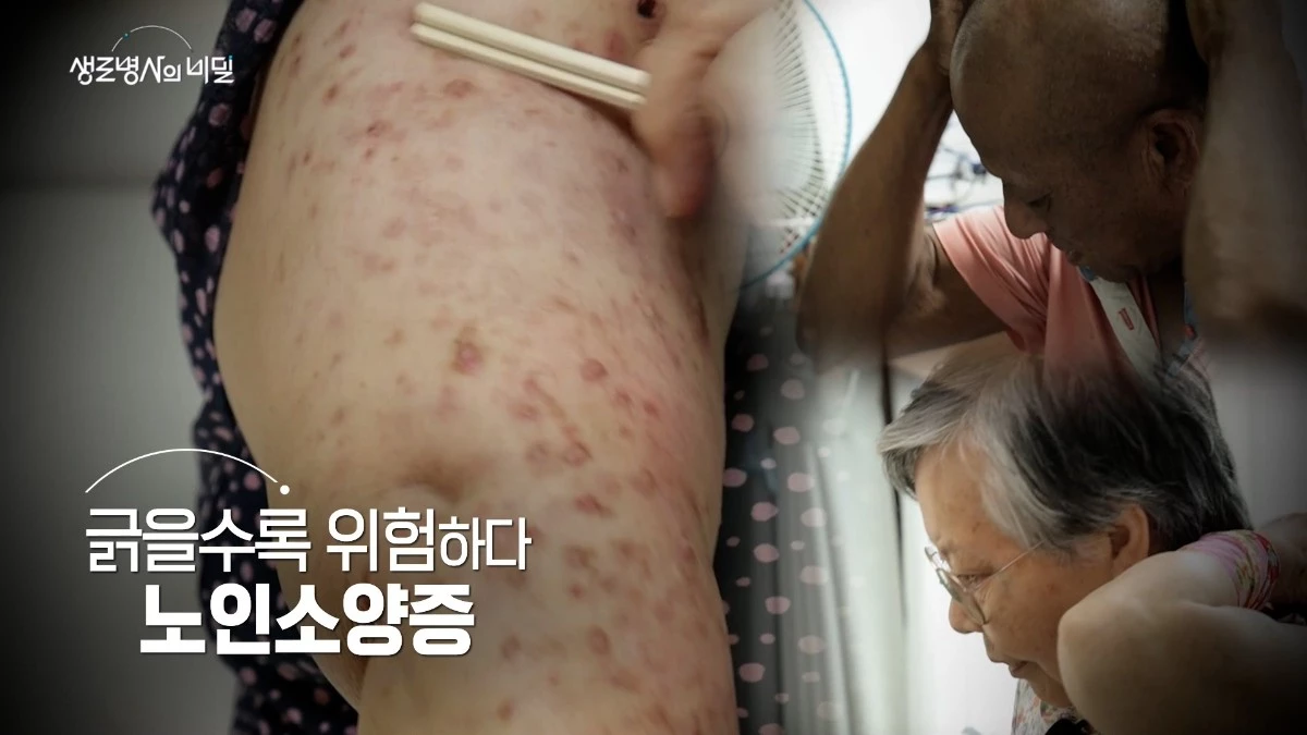 '생로병사의 비밀' 21일 방송되는 1012회 방송 자료. / KBS1